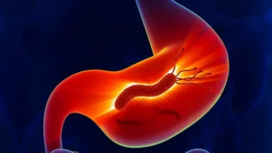 اعراض جرثومة المعدة h pylori