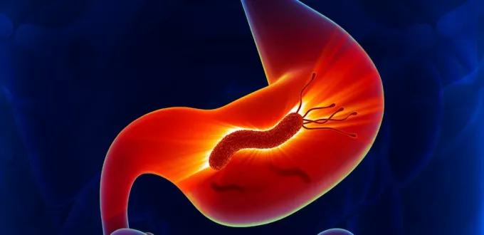 ترند العالم اعراض جرثومة المعدة h pylori اعراض جرثومة المعدة h pylori