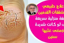 ترند العالم اسباب خشونة القدمين - جمال المرأة اسباب خشونة القدمين - جمال المرأة