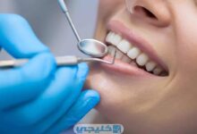 رواتب أطباء الأسنان في الكويت