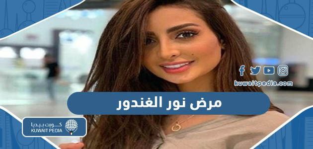 ما هو مرض نور الغندور وهل هو خطير