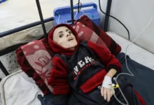 صور الطفل يزن الكفارنة الذي استشهد في غزة جوعا
