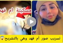 شاهد حصريا.. تسريب صور ام فهد في الطب العدلي +18 تلكرام بدون تغويش