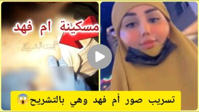 شاهد حصريا.. تسريب صور ام فهد في الطب العدلي +18 تلكرام بدون تغويش