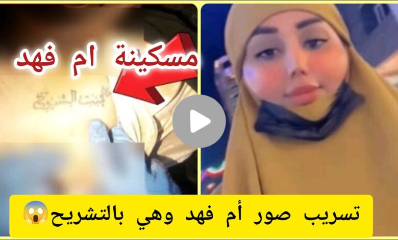 شاهد حصريا.. تسريب صور ام فهد في الطب العدلي +18 تلكرام بدون تغويش