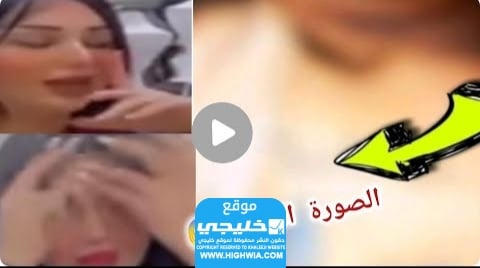 صور أم فهد في الطب الشرعي