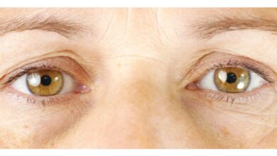 كيفية التغلب على الهالات السوداء حول العينين وتحقيق بشرة نضرة ومشرقة