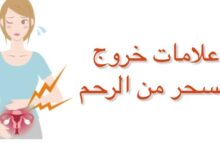 هل الحكه من علامات خروج السحر