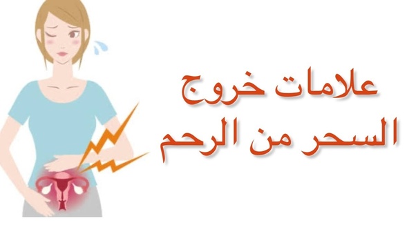 هل الحكه من علامات خروج السحر