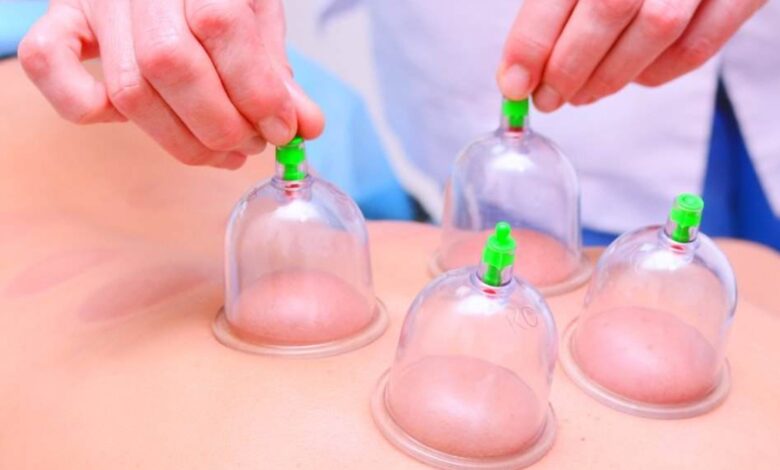 أفضل أيام الحجامة في شهر يونيو حزيران 2025