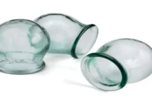 افضل الأيام لعمل الحجامة في شهر سبتمبر/ أيلول 2025